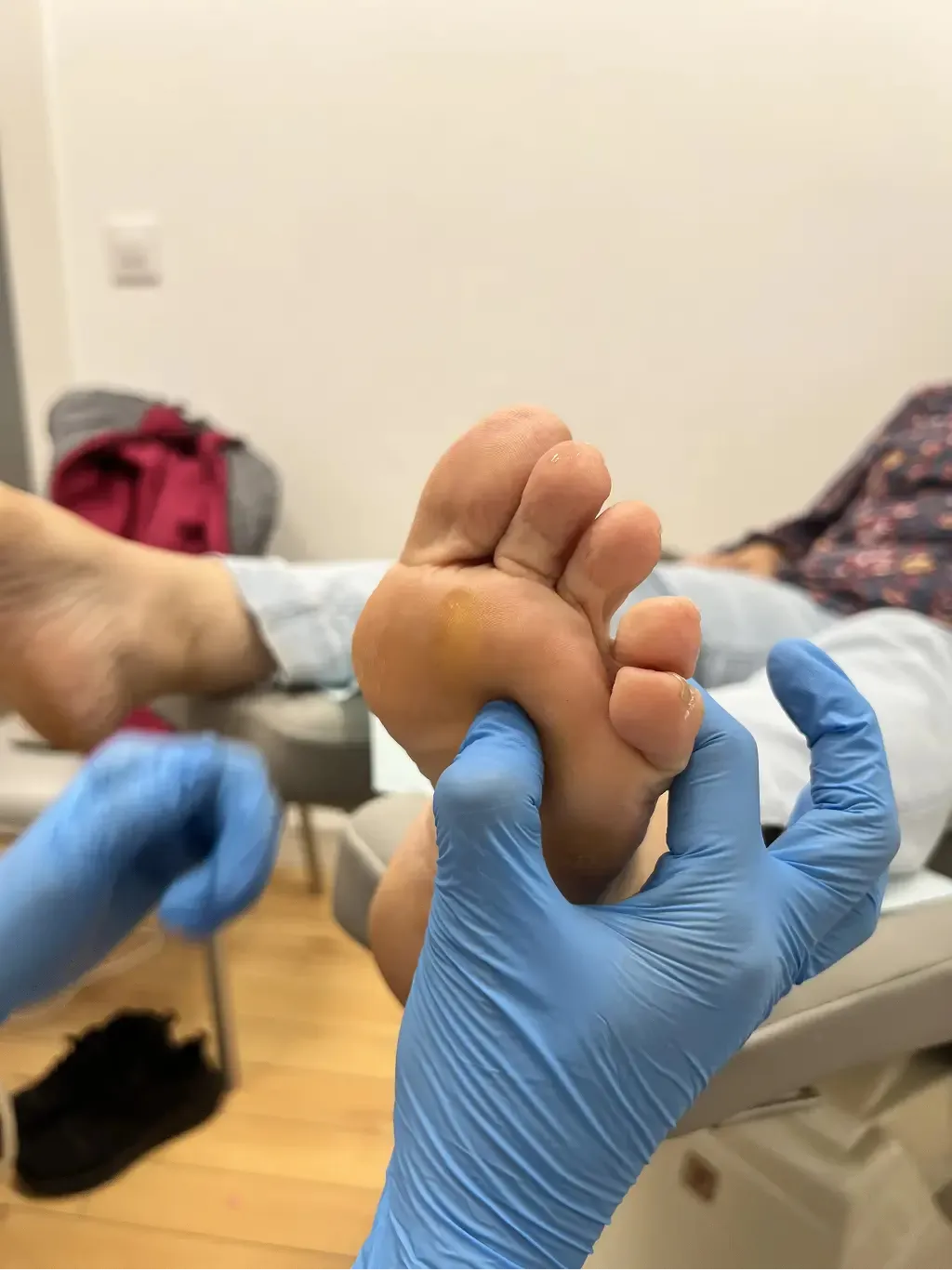 Corredora con dolor en el antepié por neuroma de Morton durante entrenamiento