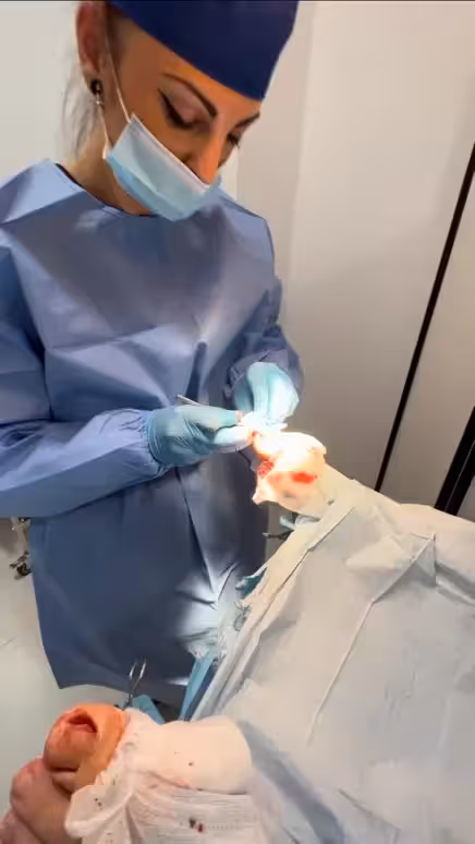 Cirugía ungueal para uña encarnada en Bilbao