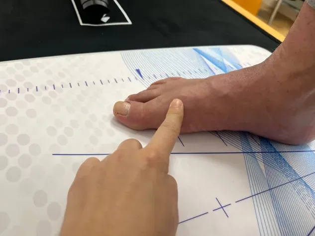 Imagen ecográfica de una articulación del pie sin artrosis mostrando cartílago articular conservado