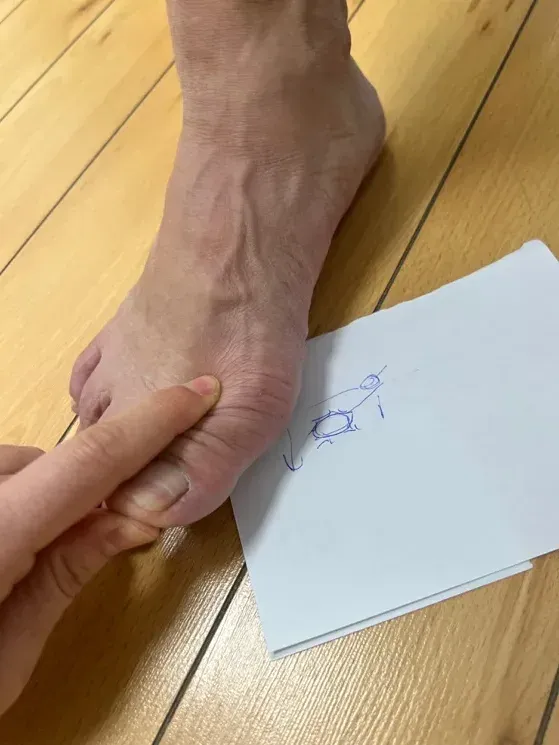 Ejercicio de reeducación del primer radio con diagrama biomecánico en Centro Podológico Henao