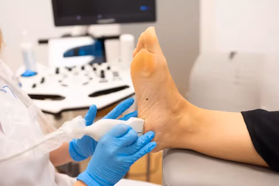 Electrólisis percutánea para fascitis plantar en Bilbao