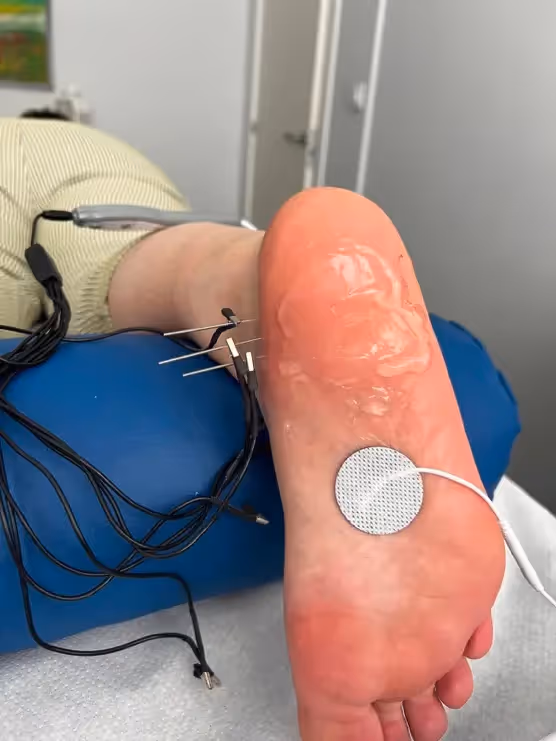 Electrólisis percutánea intratisular ecoguiada en Bilbao