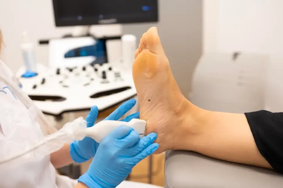 Electrólisis percutánea ecoguiada aplicada en tendón de Aquiles