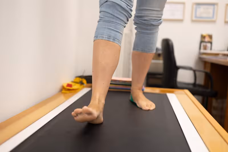 Paciente caminando descalza en cinta con plataforma de presiones para estudio biomecánico