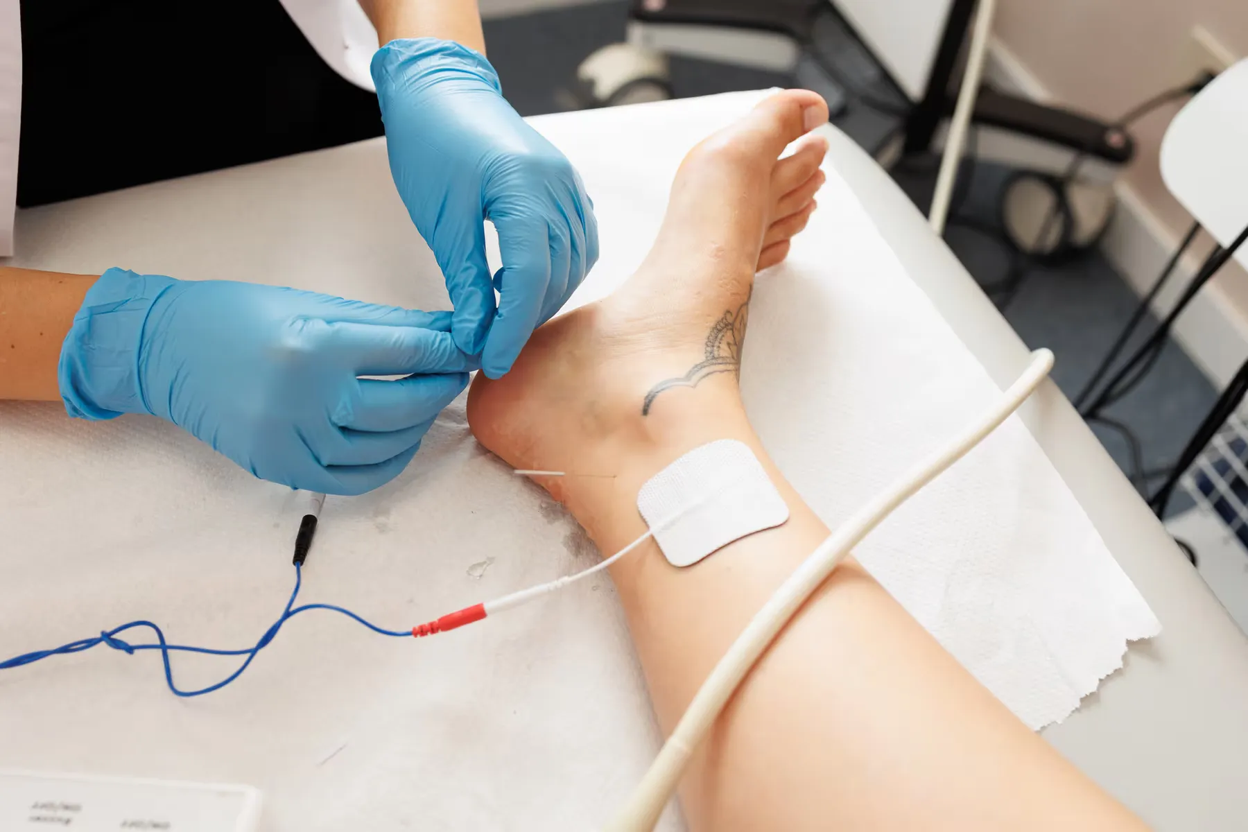 Neuromodulación