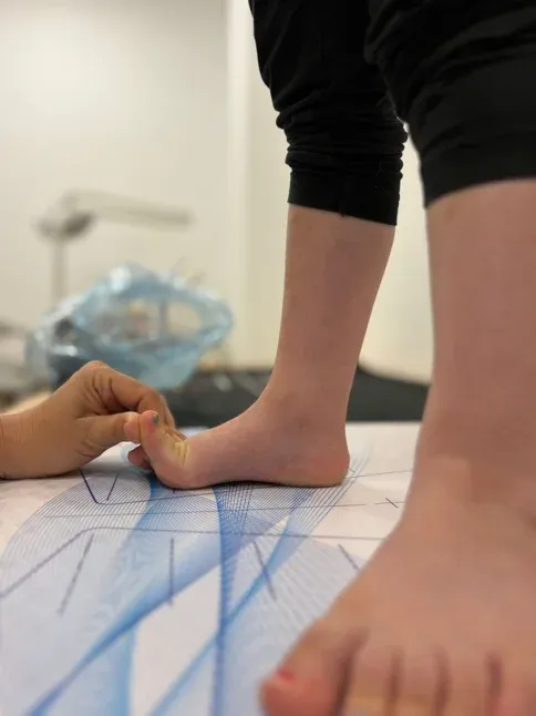 Pie infantil sobre plataforma de análisis de pisada durante estudio biomecánico en consulta de podología infantil Bilbao