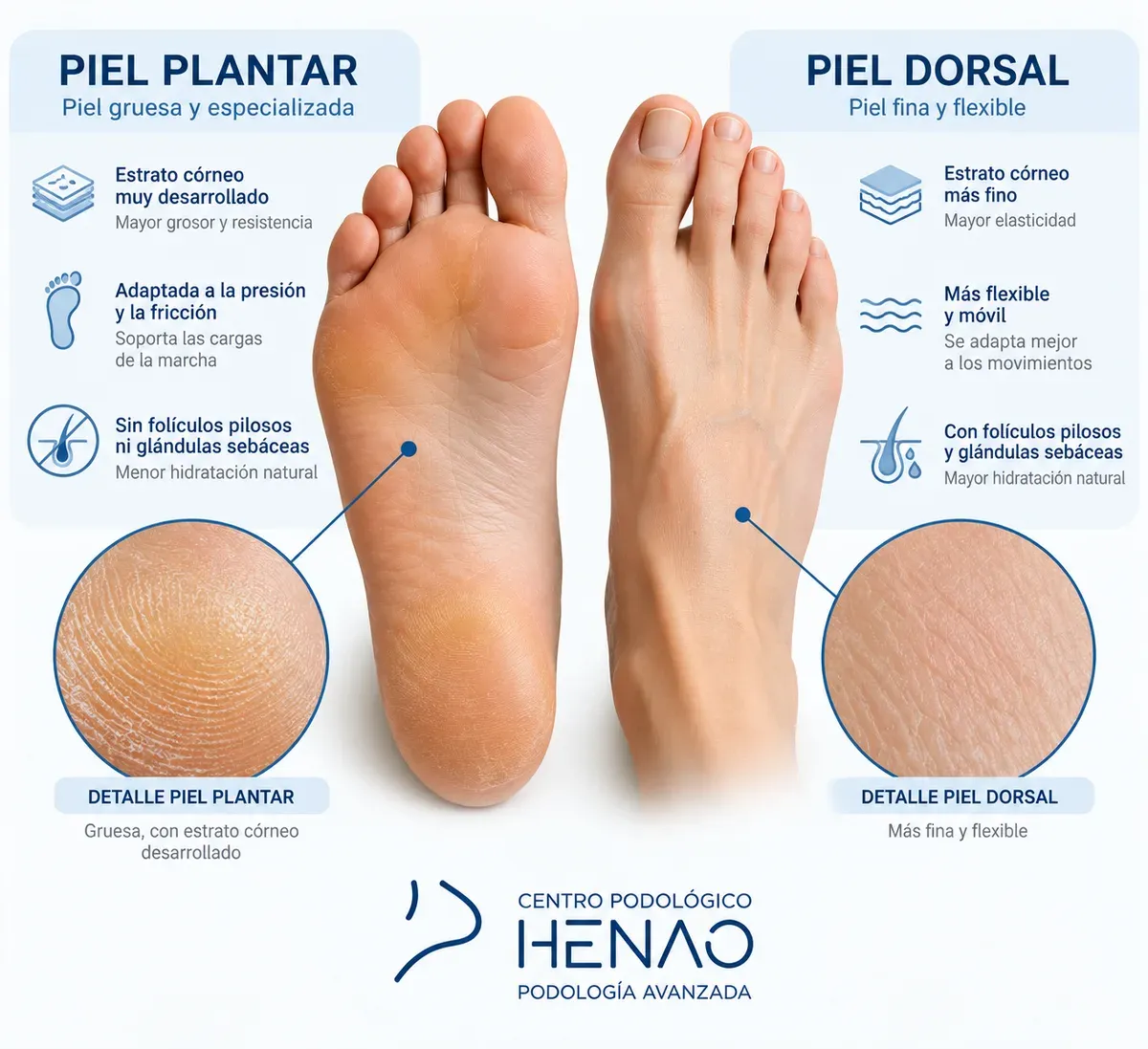 Infografía que compara la piel plantar, gruesa y adaptada a la presión, con la piel dorsal del pie, más fina y flexible