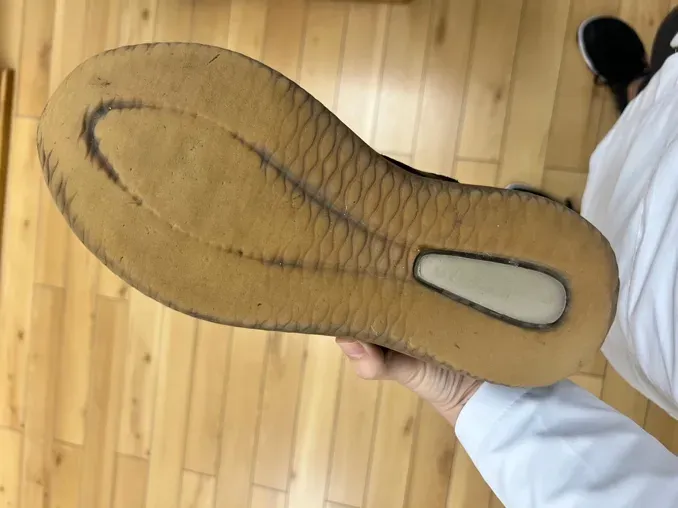 Plataforma de presiones mostrando sobrecarga marcada en la zona anterior del pie