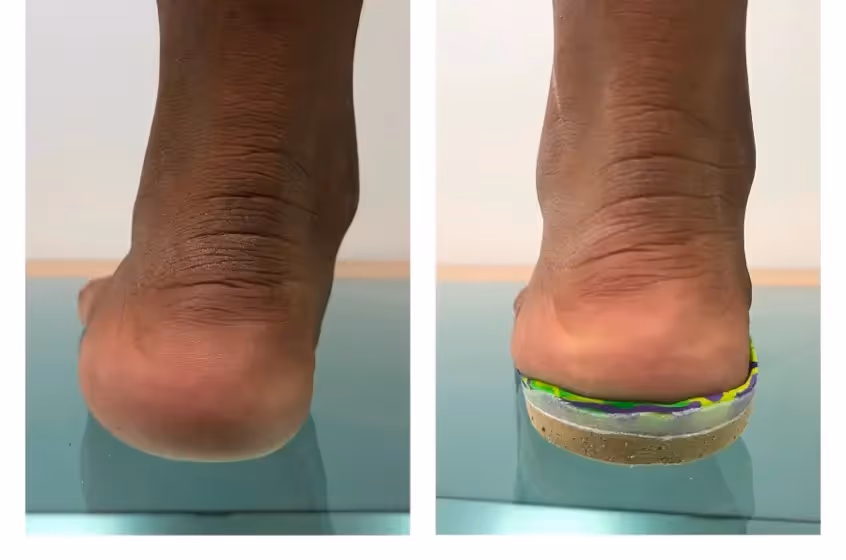 Podología infantil en Centro Podológico Henao Bilbao