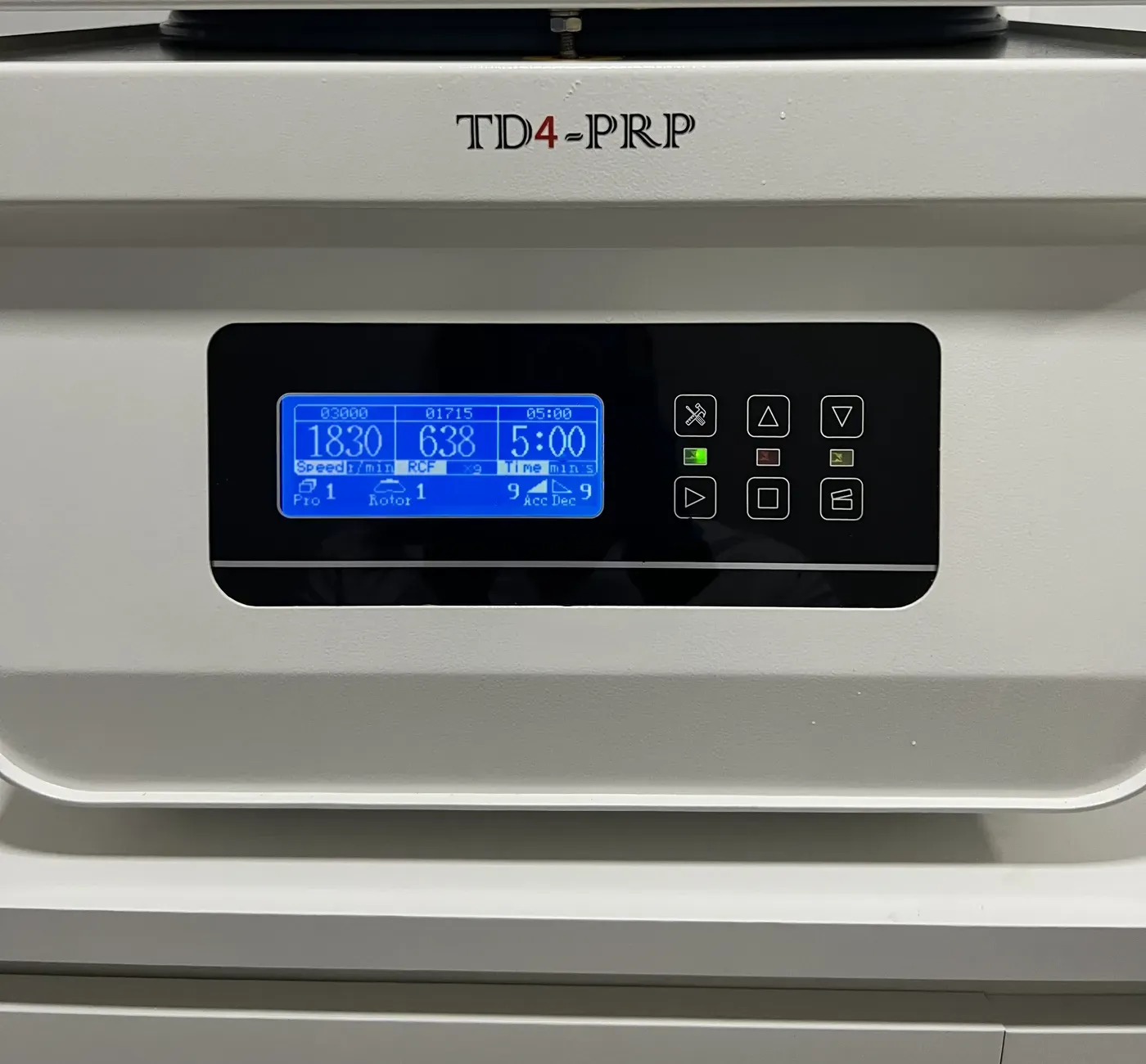 Centrifugadora TD4-PRP con la que se prepara el plasma rico en plaquetas a partir de la sangre del paciente en Centro Podológico Henao, Bilbao