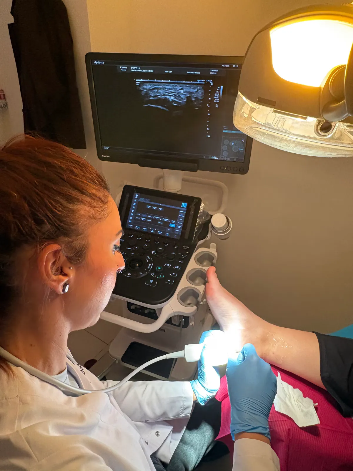 Ecografía musculoesquelética del pie para identificar todas las estructuras lesionadas antes de una infiltración en Centro Podológico Henao Bilbao