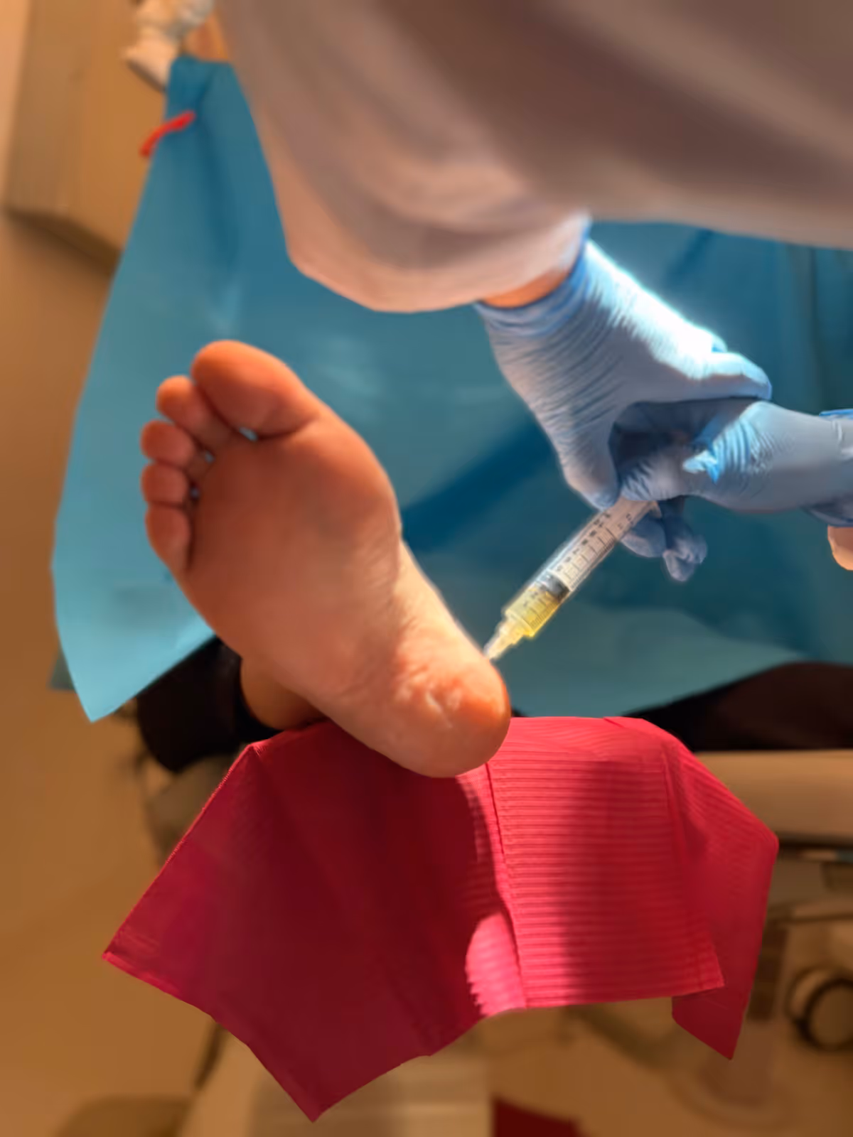 Infiltración ecoguiada de plasma rico en plaquetas en la fascia plantar en Centro Podológico Henao
