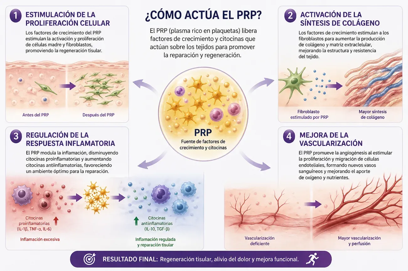 Infografía sobre cómo actúa el plasma rico en plaquetas: estimulación de la proliferación celular, activación de la síntesis de colágeno, regulación de la respuesta inflamatoria y mejora de la vascularización