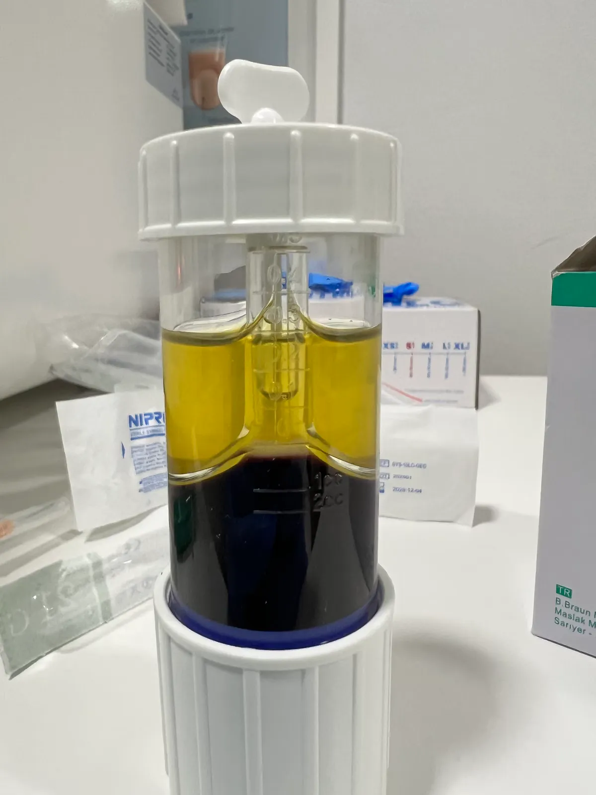 Separación de las fases sanguíneas tras la centrifugación en el tubo: plasma rico en plaquetas en la fracción superior amarilla y eritrocitos concentrados en la fracción inferior