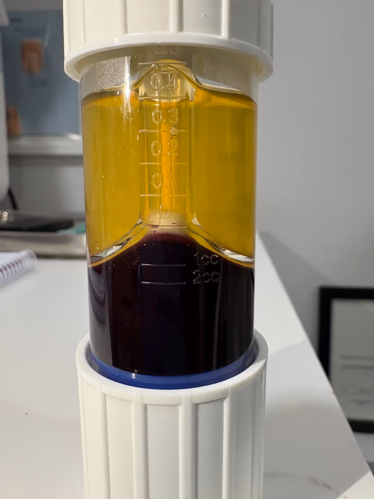 Tubo separador con plasma rico en plaquetas tras centrifugación: fracción amarilla rica en plaquetas sobre eritrocitos