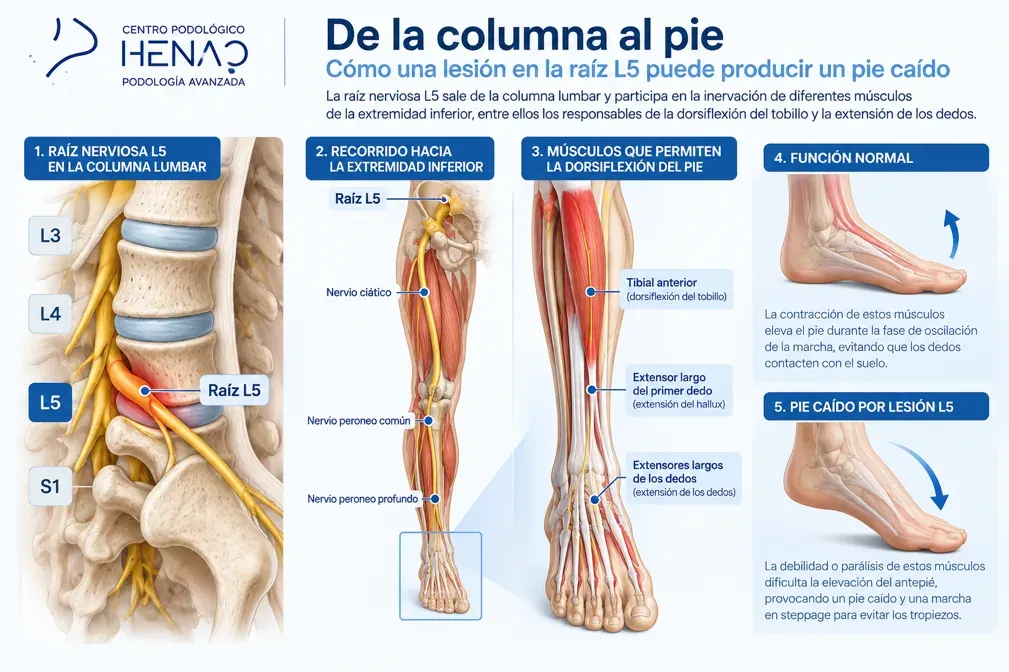 Infografía del recorrido de la raíz L5 hasta los músculos dorsiflexores del tobillo