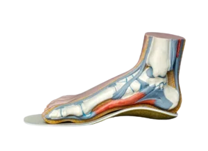 Plantillas ortopédicas personalizadas - Centro Henao