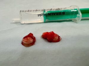 Estado a las 48 horas