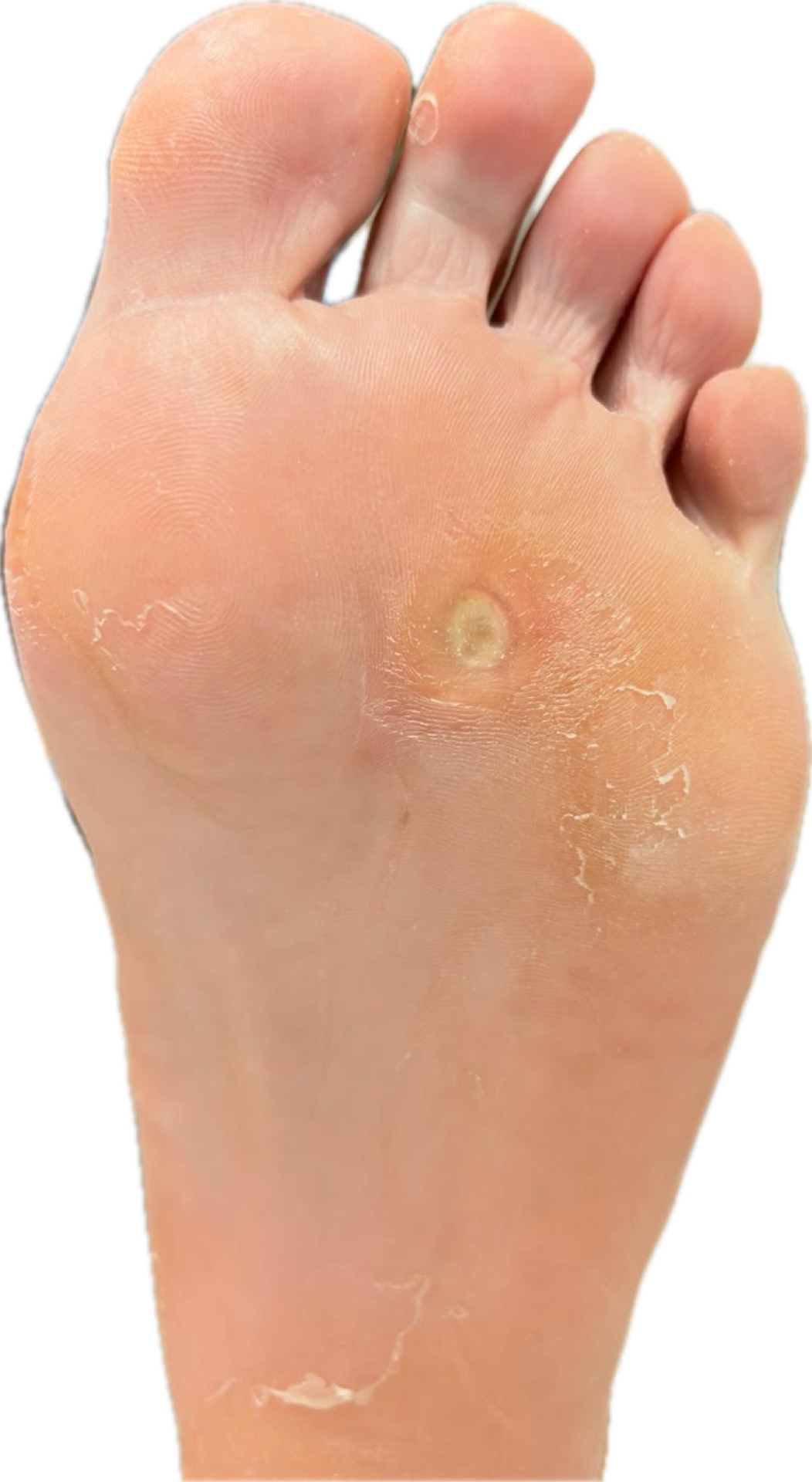 Planificación del tratamiento