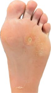 Planificación del tratamiento