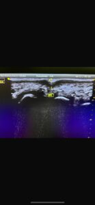 Seguimiento postquiropedia